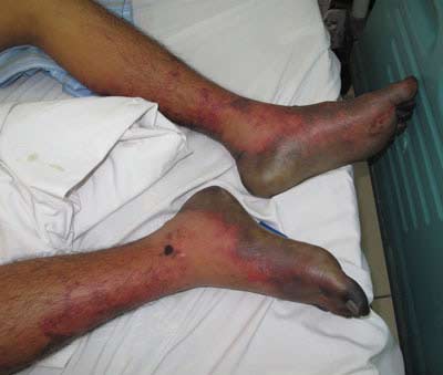 Ăn[-]tiết[-]canh,[-]phải[-]đón[-]Tết[-]ở[-]bệnh[-]viện